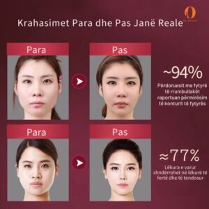 v-face-fytyra-beauty-device